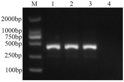 Development and application of a quantitative real-time PCR method for detection of Decapod iridescent virus 1